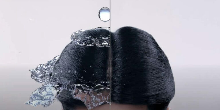 Best Anti Dandruff Shampoo In India 2021 – Reviews & Buyer’s Guide